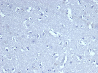 Anti-CD8 alpha antibody [CD8/4391R] used in IHC (Paraffin sections) (IHC-P). GTX02616