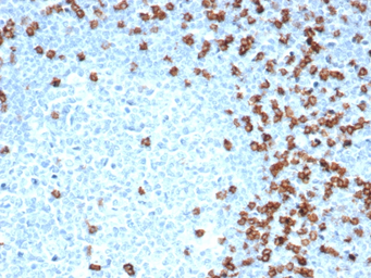 Anti-CD8 alpha antibody [CD8/4391R] used in IHC (Paraffin sections) (IHC-P). GTX02616