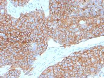 Anti-E-Cadherin antibody [CDH1/2208R] used in IHC (Paraffin sections) (IHC-P). GTX02618