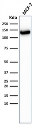 Anti-E-Cadherin antibody [CDH1/2208R] used in Western Blot (WB). GTX02618