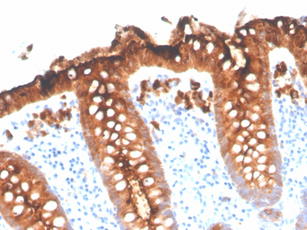 Anti-CD66e antibody [C66/3707R] used in IHC (Paraffin sections) (IHC-P). GTX02620