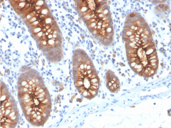 Anti-CD66e antibody [C66/3707R] used in IHC (Paraffin sections) (IHC-P). GTX02620