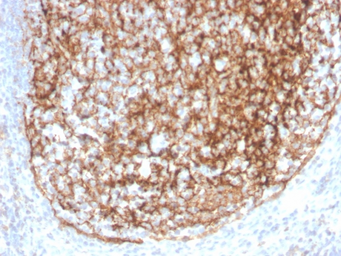 Anti-CD35 antibody [CR1/4382R] used in IHC (Paraffin sections) (IHC-P). GTX02623