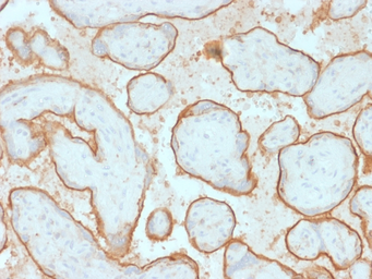 Anti-EGFR antibody [GFR/2600R] used in IHC (Paraffin sections) (IHC-P). GTX02628