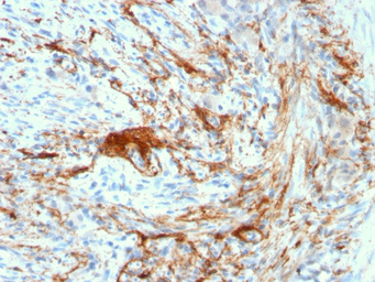 Anti-Elastin antibody [ELN/3131R] used in IHC (Paraffin sections) (IHC-P). GTX02630