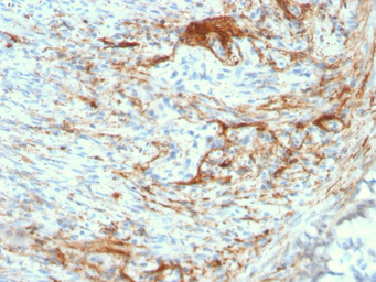Anti-Elastin antibody [ELN/3131R] used in IHC (Paraffin sections) (IHC-P). GTX02630