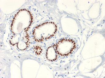 Anti-Estrogen Receptor alpha antibody [ESR1/2299R] used in IHC (Paraffin sections) (IHC-P). GTX02635