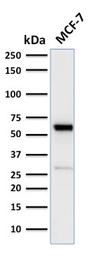 Anti-Estrogen Receptor alpha antibody [ESR1/2299R] used in Western Blot (WB). GTX02635