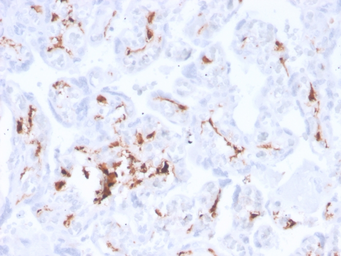 Anti-Factor XIIIa antibody [F13A1/3772R] used in IHC (Paraffin sections) (IHC-P). GTX02636
