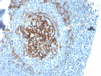 Anti-CD23 antibody [FCER2/4395R] used in IHC (Paraffin sections) (IHC-P). GTX02637