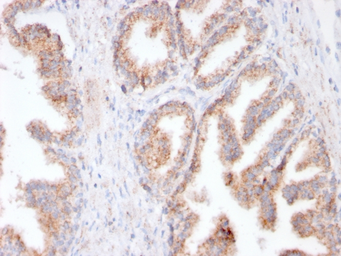 Anti-PSMA antibody [FOLH1/3149R] used in IHC (Paraffin sections) (IHC-P). GTX02639