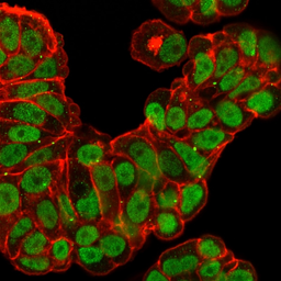 Anti-FOXA1 antibody [FOXA1/2230R] used in Immunocytochemistry/ Immunofluorescence (ICC/IF). GTX02640