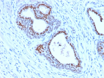 Anti-FOXA1 antibody [FOXA1/2230R] used in IHC (Paraffin sections) (IHC-P). GTX02640