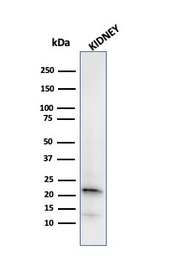 Anti-Ferritin Light Chain antibody [FTL/2338R] used in Western Blot (WB). GTX02641
