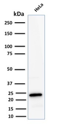 Anti-Ferritin Light Chain antibody [FTL/2338R] used in Western Blot (WB). GTX02641