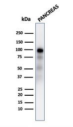 Anti-GP2 antibody [GP2/2569R] used in Western Blot (WB). GTX02645