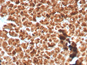 Anti-GP2 antibody [GP2/3134R] used in IHC (Paraffin sections) (IHC-P). GTX02646