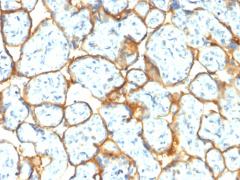 Anti-Insulin Receptor alpha antibody [INSR/2277R] used in IHC (Paraffin sections) (IHC-P). GTX02652