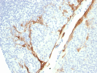 Anti-Cytokeratin 16 antibody [rKRT16/1714] used in IHC (Paraffin sections) (IHC-P). GTX02655
