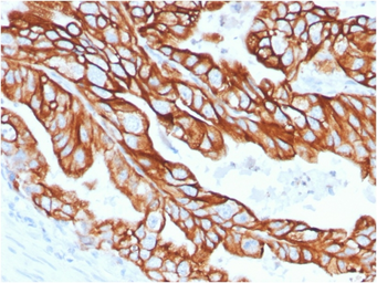 Anti-Cytokeratin 18 antibody [KRT18/2808R] used in IHC (Paraffin sections) (IHC-P). GTX02657