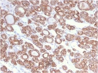 Anti-Cytokeratin 18 antibody [KRT18/2808R] used in IHC (Paraffin sections) (IHC-P). GTX02657