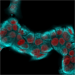 Anti-Cytokeratin 18 antibody [KRT18/2819R] used in Immunocytochemistry/ Immunofluorescence (ICC/IF). GTX02658