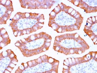 Anti-Cytokeratin 20 antibody [KRT20/3129R] used in IHC (Paraffin sections) (IHC-P). GTX02660
