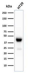Anti-Cytokeratin 20 antibody [KRT20/3129R] used in Western Blot (WB). GTX02660