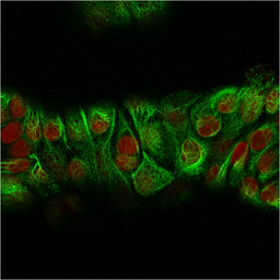 Anti-Cytokeratin 2 antibody [KRTH/2147R] used in Immunocytochemistry/ Immunofluorescence (ICC/IF). GTX02662