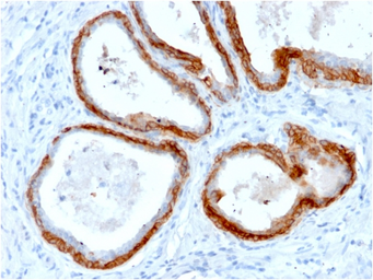 Anti-Cytokeratin 2 antibody [KRTH/2147R] used in IHC (Paraffin sections) (IHC-P). GTX02662