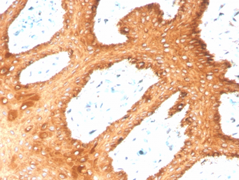 Anti-Cytokeratin 2 antibody [KRTH/4392R] used in IHC (Paraffin sections) (IHC-P). GTX02665
