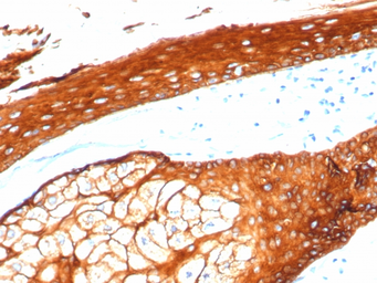 Anti-Cytokeratin 2 antibody [KRTH/4392R] used in IHC (Paraffin sections) (IHC-P). GTX02665