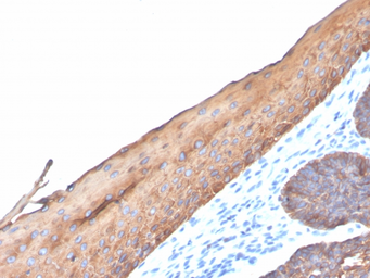 Anti-Keratin 77 antibody [KRTL/4440R] used in IHC (Paraffin sections) (IHC-P). GTX02666