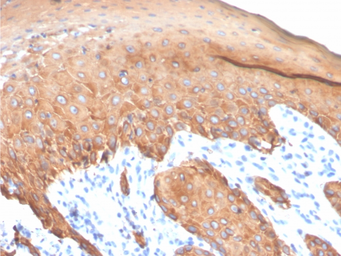 Anti-Keratin 77 antibody [KRTL/4440R] used in IHC (Paraffin sections) (IHC-P). GTX02666