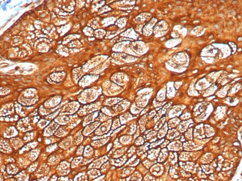 Anti-Keratin 77 antibody [KRTL/4440R] used in IHC (Paraffin sections) (IHC-P). GTX02666