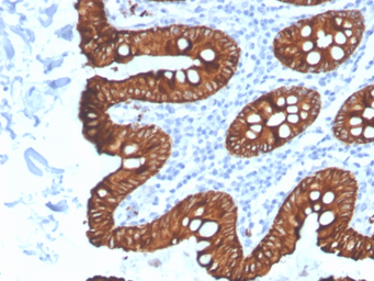 Anti-Cytokeratin 8 antibody [KRT8/4067R] used in IHC (Paraffin sections) (IHC-P). GTX02668