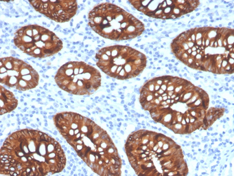 Anti-Cytokeratin 8 antibody [KRT8/4067R] used in IHC (Paraffin sections) (IHC-P). GTX02668