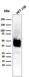 Anti-Cytokeratin 8 antibody [KRT8/4067R] used in Western Blot (WB). GTX02668