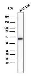 Anti-Cytokeratin 8 antibody [KRT8/2174R] used in Western Blot (WB). GTX02669
