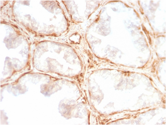 Anti-Galectin 1 antibody [GAL1/2499R] used in IHC (Paraffin sections) (IHC-P). GTX02670