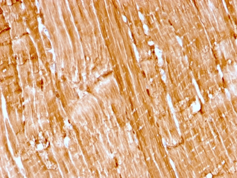 Anti-Myoglobin antibody [rMB/2105] used in IHC (Paraffin sections) (IHC-P). GTX02672