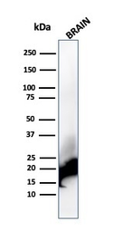 Anti-Myelin basic protein antibody [rMBP/4288] used in Western Blot (WB). GTX02673