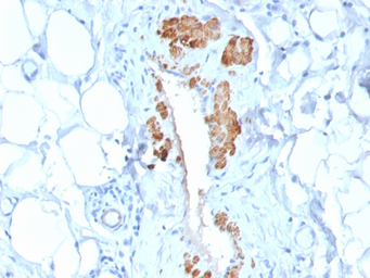 Anti-Myosin Heavy Chain 11 antibody [MYH11/2303R] used in IHC (Paraffin sections) (IHC-P). GTX02683