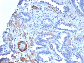 Anti-Myosin Heavy Chain 11 antibody [MYH11/2303R] used in IHC (Paraffin sections) (IHC-P). GTX02683