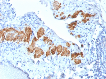 Anti-Myosin Heavy Chain 11 antibody [MYH11/2303R] used in IHC (Paraffin sections) (IHC-P). GTX02683