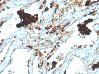 Anti-Napsin A antibody [NAPSA/4400R] used in IHC (Paraffin sections) (IHC-P). GTX02684