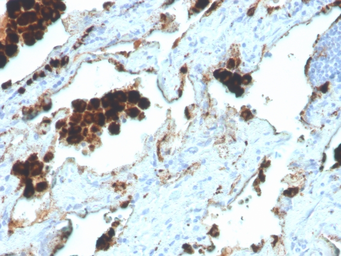 Anti-Napsin A antibody [NAPSA/4400R] used in IHC (Paraffin sections) (IHC-P). GTX02684