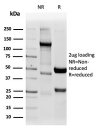 Anti-Napsin A antibody [NAPSA/4400R] used in Protein Array (Protein Array). GTX02684