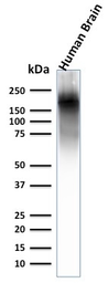 Anti-NF-H antibody [NEFL.H/2324R] used in Western Blot (WB). GTX02687