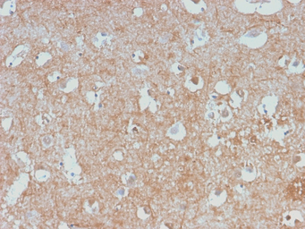Anti-NF-L antibody [NEFL/2983R] used in IHC (Paraffin sections) (IHC-P). GTX02688